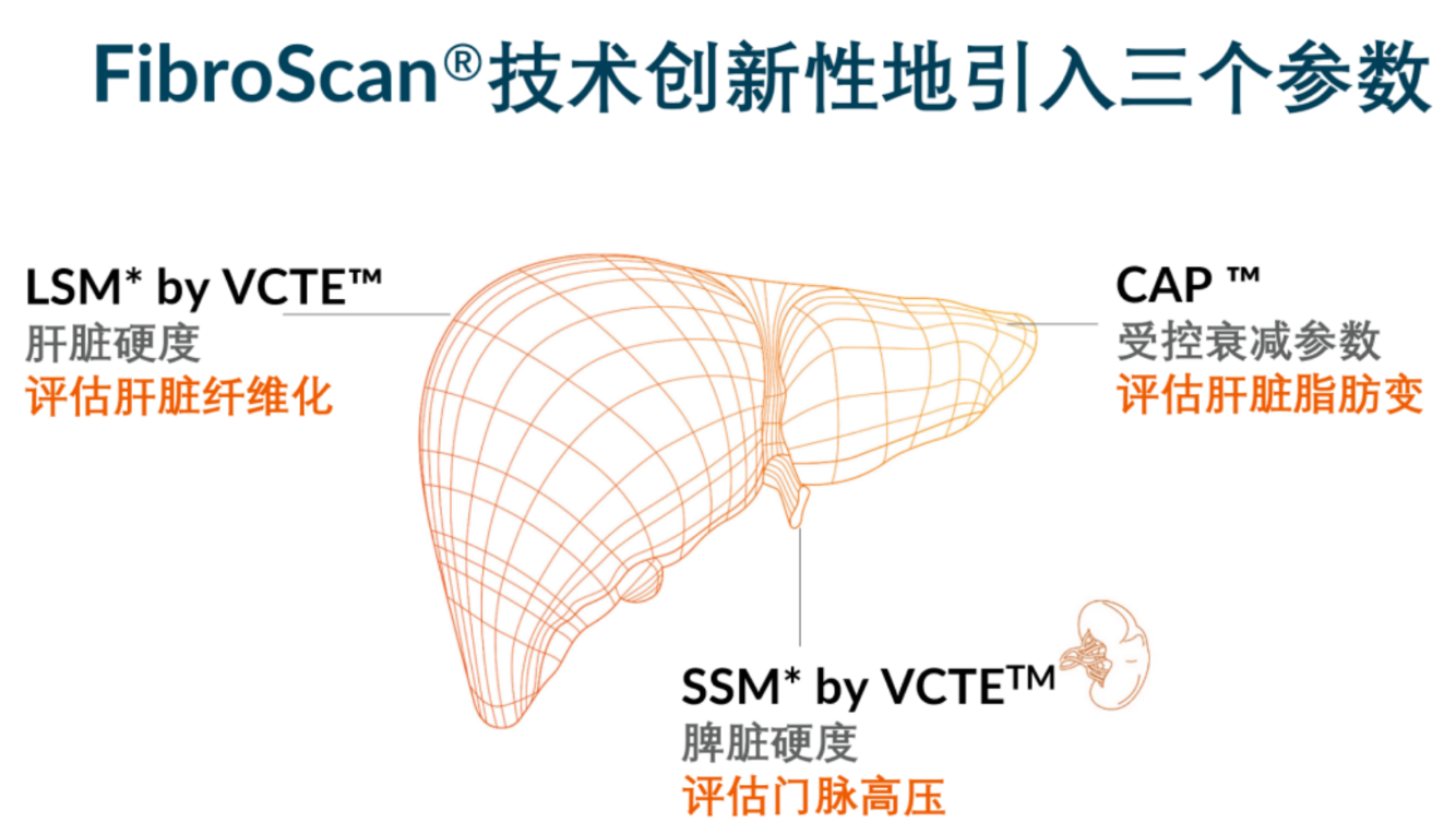 喜訊！FDA擴(kuò)大了FibroScan?在肝臟綜合管理中的應(yīng)用范圍